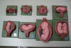 7个月胎儿多重（7个月胎儿多重属于正常）