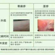 孕期过敏性荨麻疹（孕期过敏性荨麻疹怎么办）