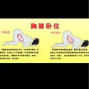 胎儿靠下怎么调整（胎儿靠下怎么调整）