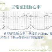 胎儿生物物理监测（孕22周胎动减少是怎么回事）