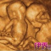 孕5月胎儿大小（5月龄宝宝能看多少米）