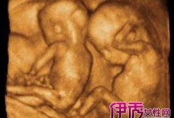 孕5月胎儿大小（5月龄宝宝能看多少米）
