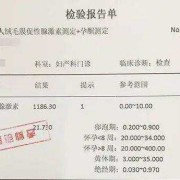 蚋虫绒毛怎么获取,胎儿绒毛提取流程