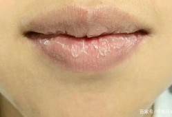 孕期嘴唇脱皮（嘴唇脱皮是怎么回事,嘴唇脱皮是缺什么）