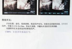 孕晚期熬夜胎儿死了（怀孕八个月死胎的原因是什么）