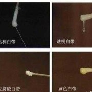孕期阴道分泌物（孕期白色分泌物多正常吗）