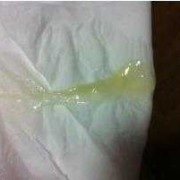 怀孕期间白带发黄对宝宝有影响吗,孕妇尿完尿一擦黄绿色分泌物