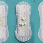 孕期粘液丝高（怀孕期间出现像鼻涕一样的分泌物正常吗）