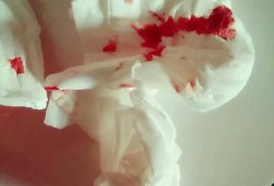 孕期鼻子出血（孕期鼻子出血怎么回事正常吗）