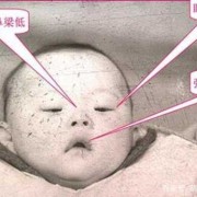 怀唐氏儿的孕妈妈有什么症状呀,唐氏儿孕妇孕期症状