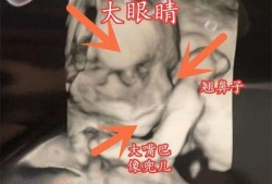 胎儿鼻子大是男孩吗（胎儿鼻子大是男孩吗还是女孩）