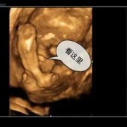 四维彩超检查胎儿耳朵吗,四维胎儿耳朵大小不一样