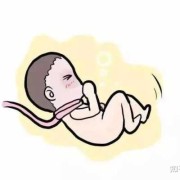 23周胎儿脐带绕颈一周怎么办（23周胎儿脐带绕颈一周怎么办?）
