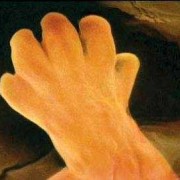 怀孕7个月。左侧躺的时候宝宝动的厉害,胎儿动的多好还是动的少好