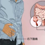 怀孕两个月右侧小腹疼痛怎么回事,孕期右下腹疼痛的原因