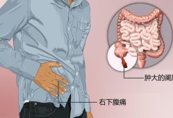 怀孕两个月右侧小腹疼痛怎么回事,孕期右下腹疼痛的原因