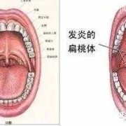 孕期喉咙痛怎么回事,怀孕期间喉咙痛怎么办咽口水都痛