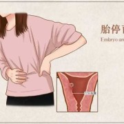 导致胎儿停止发育的原因（导致胎儿停止发育的原因有哪些）