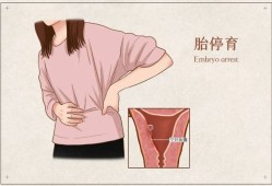 导致胎儿停止发育的原因（导致胎儿停止发育的原因有哪些）