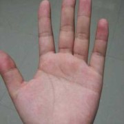 手心发红是怎么回事,孕期手掌发红的原因