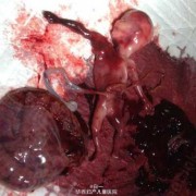 13周可以人流吗,孕期13周可以同房吗有影响吗