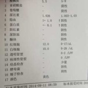 怀孕期间尿检（怀孕期间尿检有隐血对胎儿有影响吗）