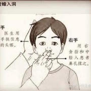 怀孕期间鼻塞怎么办（怀孕期间鼻塞怎么办呢）