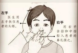 怀孕期间鼻塞怎么办（怀孕期间鼻塞怎么办呢）