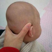 胎儿头扁的图片（扁头智商低是真的吗）