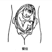 胎儿撅屁股（胎儿撅屁股蹬腿图片）