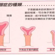 【子宫收缩不好的症状有哪些】,孕中期同房子宫收缩对胎儿有影响吗