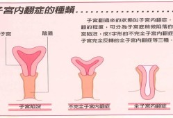 【子宫收缩不好的症状有哪些】,孕中期同房子宫收缩对胎儿有影响吗