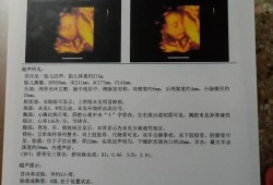 19周胎儿四维彩超（我怀孕19周了想预订四维彩超可以预约上吗）