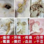 孕期白带腥味（白带有腥臭味是什么原因？该用什么药）