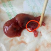 怀孕10周有什么症状？孕十周了会不会出现恶心想吐的症状呢,怀孕10周胎儿图片