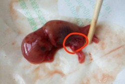 怀孕10周有什么症状？孕十周了会不会出现恶心想吐的症状呢,怀孕10周胎儿图片