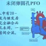 胎儿卵圆孔偏小的危害（胎儿卵圆孔偏小的危害有哪些）