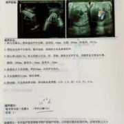 怀孕37周，做b超说胎头低是什么意思,胎儿很低在宫颈口边缘