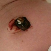 宝宝五十天了肚脐凸起来的用手按压下去感觉有水声什么回事,五十多天的胎儿图片真实