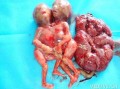 5个月引产胎儿图片（5个月引产胎儿图片是什么样子?）