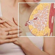 孕期乳房出水（孕五个月乳房有水流正常吗）