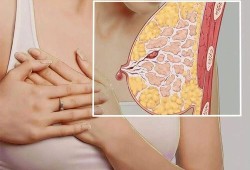 孕期乳房出水（孕五个月乳房有水流正常吗）