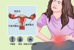 孕期宫内感染的症状（孕期宫内感染的症状）