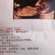 胎儿心脏发育不好是什么原因（nt的检查能查到胎儿心脏吗）