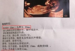 胎儿心脏发育不好是什么原因（nt的检查能查到胎儿心脏吗）