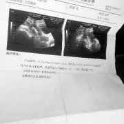 孕期检查报告（孕期检查报告医院要收回留档吗）