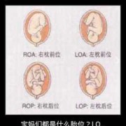 头位loa的胎儿图解（Lorael是什么意思）