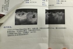 胎囊里面是胎儿吗（孕囊的读音）