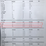 孕期尿素氮（孕期尿素氮低有什么影响）