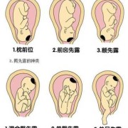 胎儿俯位（胎儿俯位）
